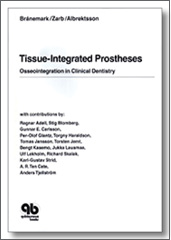 Tissue-Integrated Prostheses: Osseointegration in Clinical Dentistry, Tomas Albrektsson, Quintessence Publishing