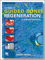 20 Years of Guided Bone Regeneration in Implant Dentistry, 2nd Edition, 2009, Daniel Buser, Quintessence Publishing