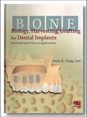 Bone Biology, Harvesting, Grafting for Dental Implants - Rationale and Clinical Applications, Arun K. Garg, Quintessence Publishing