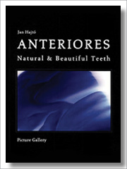 Jan Hajto Anteriores Natural and Beautiful Teeth Vol 2