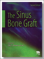 The Sinus Bone Graft, Ole T. Jensen, 2nd Edition, Quintessence Publishing