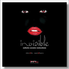 Invisible Esthetic Ceramic Restorations Sidney Kina