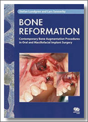 Bone Reformation: Contemporary Bone Augmentation Procedures in Oral and Maxillofacial Surgery, Stefan Lundgren, Lars Sennerby, 2008, Quintessence Publishing
