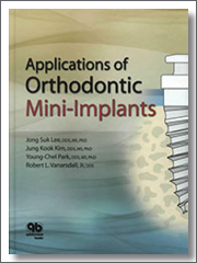 Applications of Orthodontic Mini Implants, Jong Suk Lee, Jung Kook Kim, Young-Chel Park, Robert L. Vanarsdall Jr., 2007, Quintessence Publishing