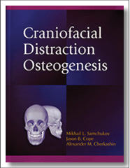 Craniofacial Distraction Osteogenesis, 1st Edition, Mikhail L. Samchukov, Mosby Elsevier Health Sciences