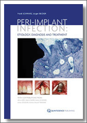 Peri-Implant Infection: Etiology, Diagnosis and Treatment, 2009, Frank Schwarz, Jurgen Becker, Quintessence Publishing
