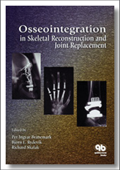 Osseointegration in Skeletal Reconstruction and Joint Replacement, Richard Skalak, Quintessence Publishing
