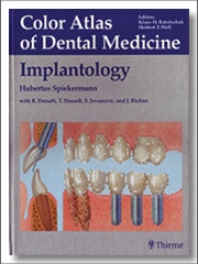 Implantology, Color Atlas of Dental Medicine, Hubertus Spiekermann, Thieme