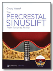 The Percrestal Sinuslift - From Illusion to Reality, 2012, Georg Watzek, Quintessence Publishing