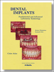 Dental Implants: Fundamental and Advanced Laboratory Technology, Robert Winkelman, 1994, Mosby-Wolfe