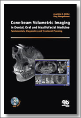 Cone-Beam Volumetric Imaging in Dental, Oral and Maxillofacial Medicine: Fundamentals, Diagnosis, and Treatment Planning, 2008, Joachim E. Zoller, Jorg Neugebauer, Quintessence Publishing
