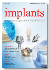 Implants, The International CE Continuing Education Magazine of Oral Implantology