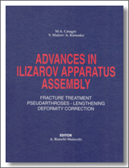 adv_ilizarov_185x240_icon