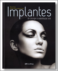 implantes_195x240_icon